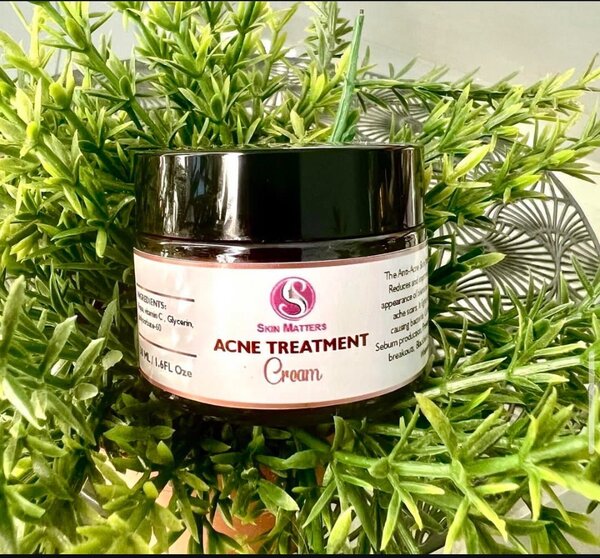 Acne Treatment Cream