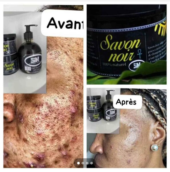 Savon noir