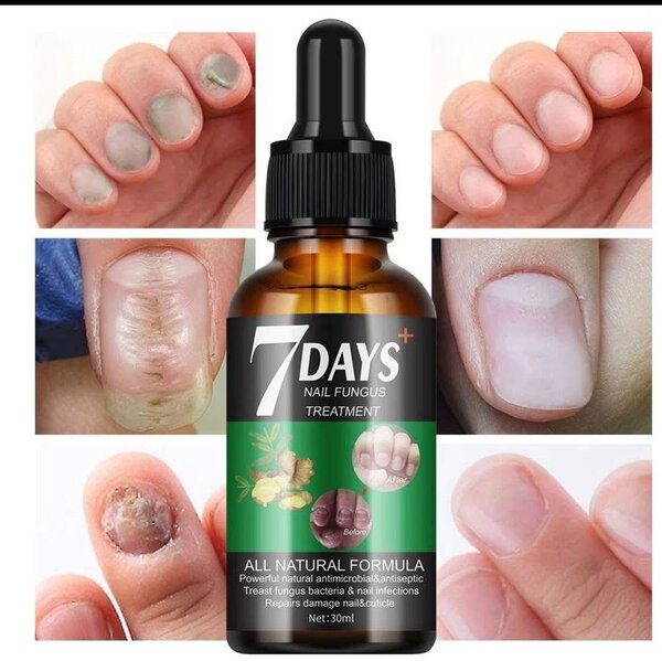 Traitement antifongique des ongles 7 Days