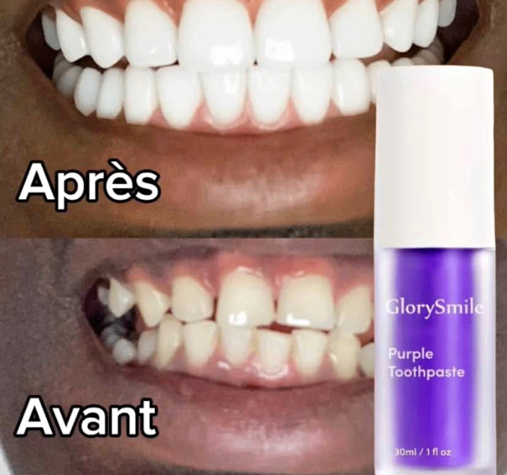 Blanchisseur dentaire