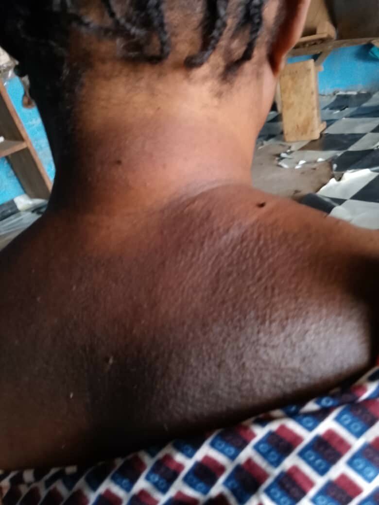 Soin Exfoliant  Peeling Mami