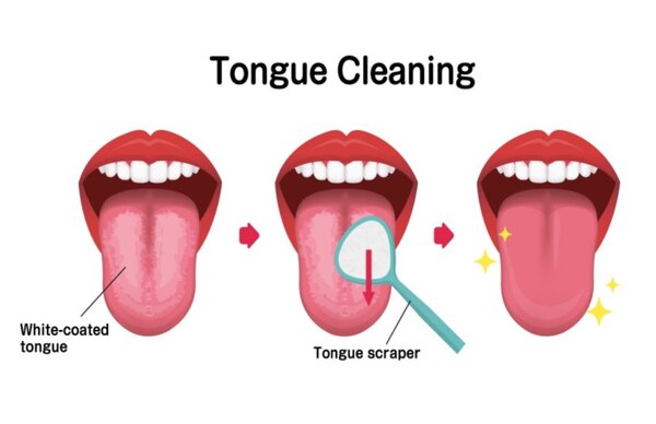 Tongue cleaner plastic