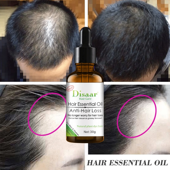 Disaar Huile Anti-Chute Cheveux