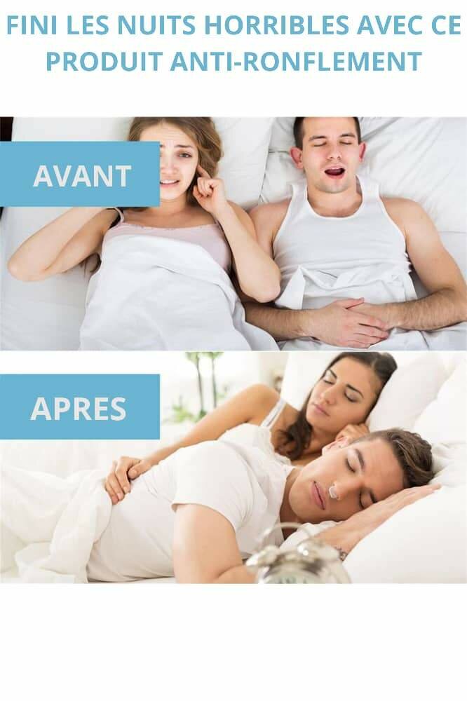 Lot de 4 Clips Anti-Ronflement