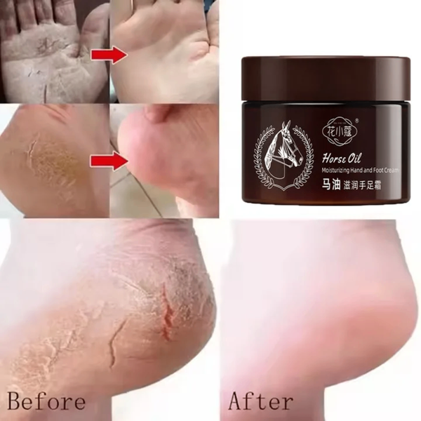 Crème Hydratante pour les Pieds et les Mains - Horse Oil