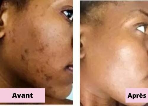 Savon à base de Carotte Papaye