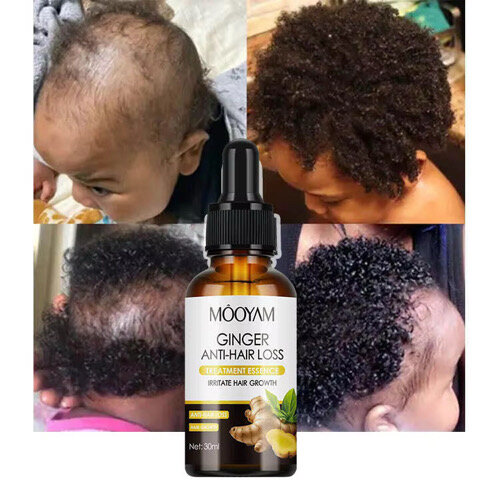 Sérum Anti-Chute Cheveux MOOYAM