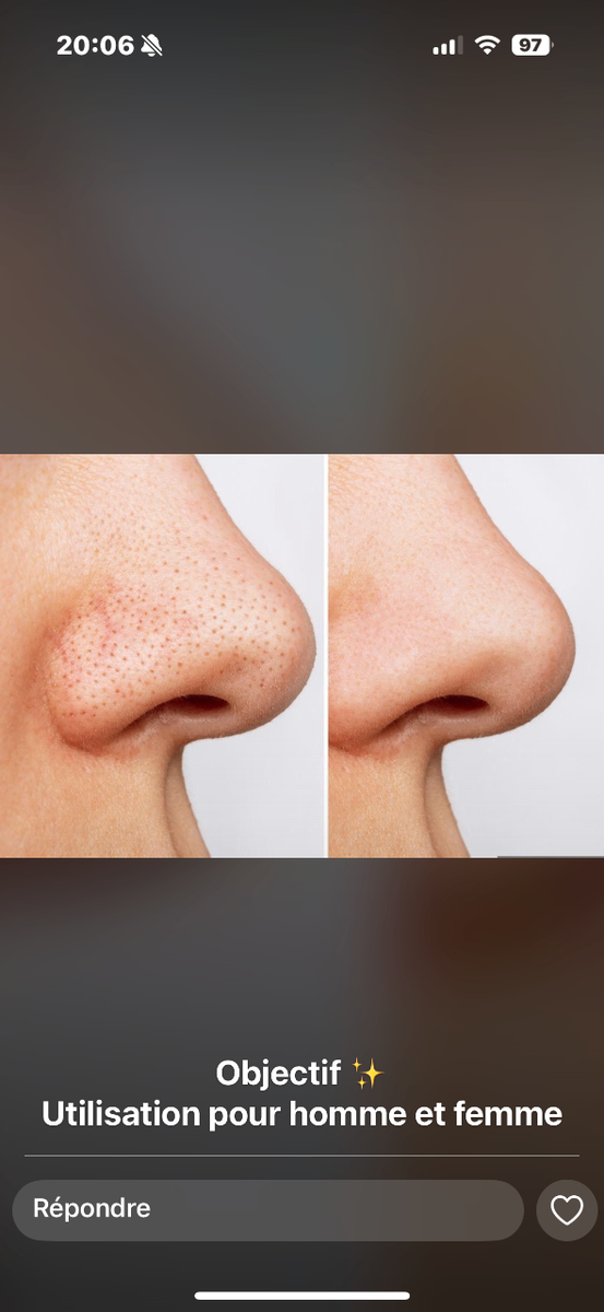 Dr Rashel Bandes Nez Exfoliantes