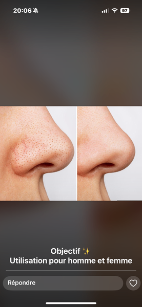 Dr Rashel Bandes Nez Exfoliantes