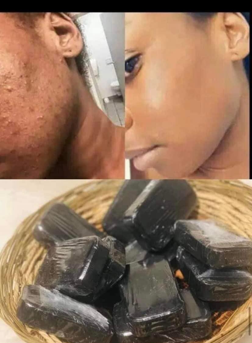 Savon miracle