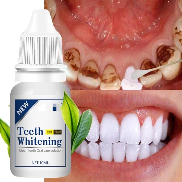 Teeth whitening products