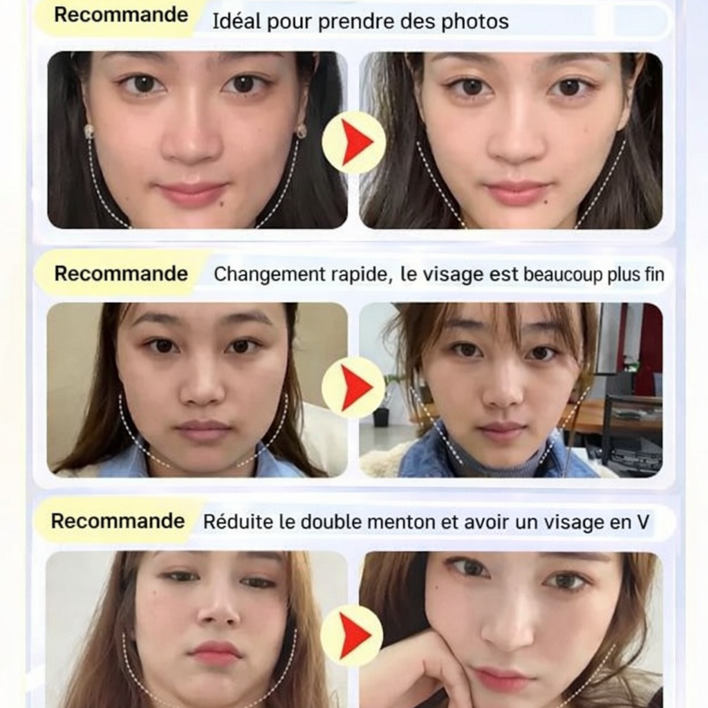 Bande de lifting du visage V-L