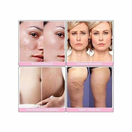 Rouleau Dermaroller Visage et Corps