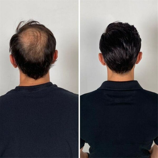 Huile Pousse Barbe Naturelle