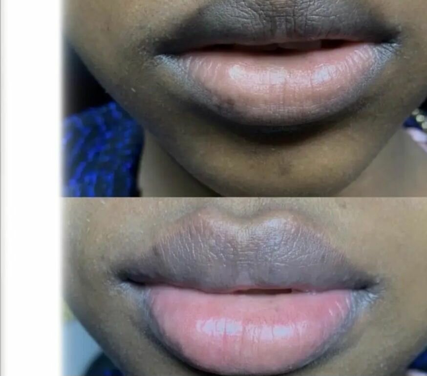 Patch lèvres hydratant PIL'ATEN