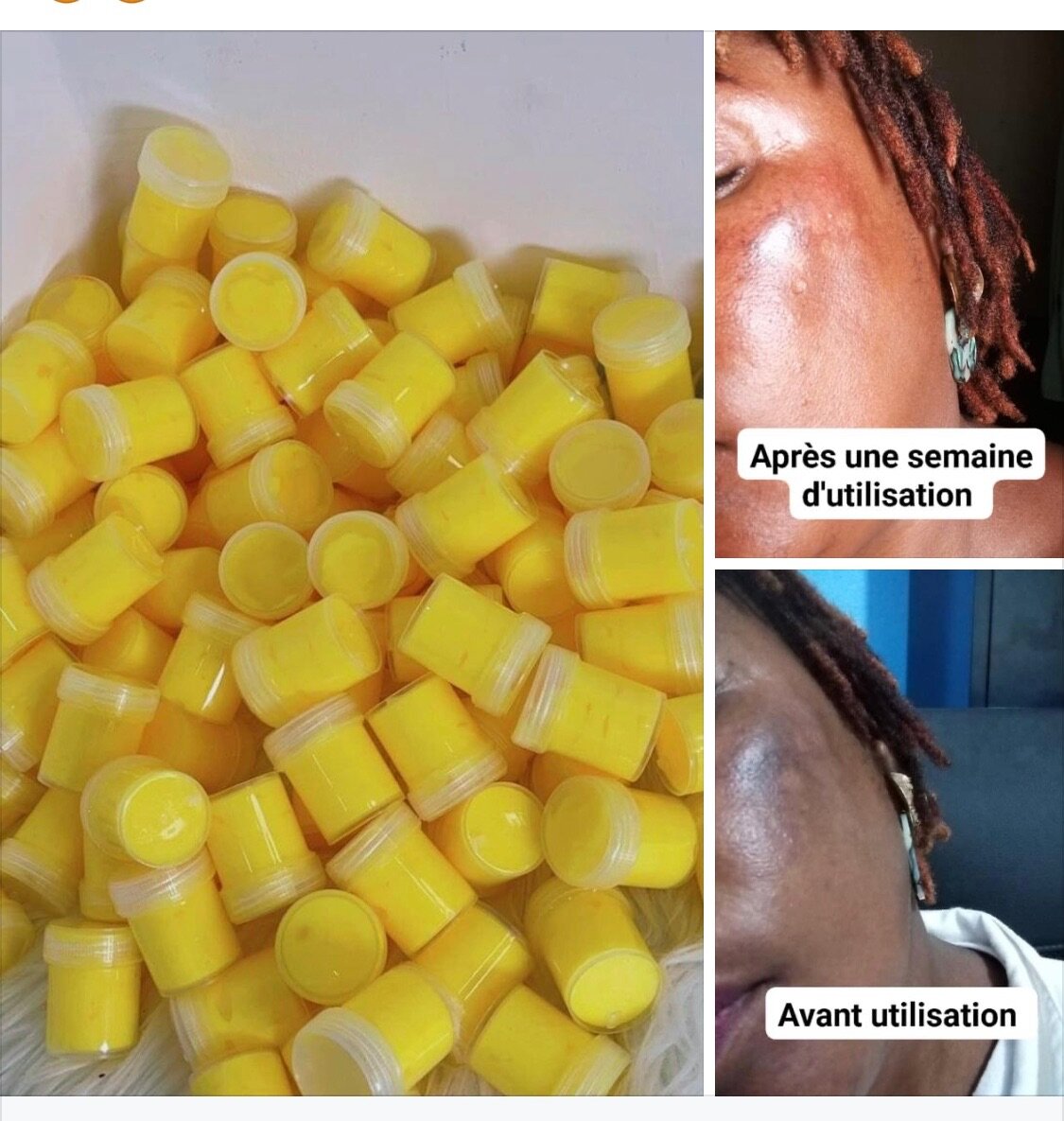 Savons tout type de teint