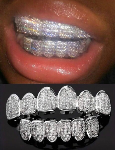 Grillz dentaires étincelants