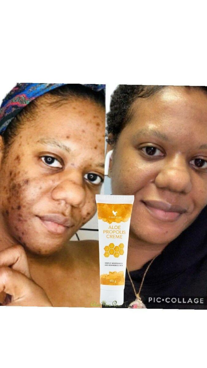 Crème Propolis Aloe Forever