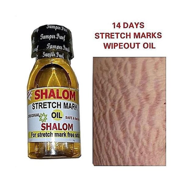 Shalom Stretch mark oil