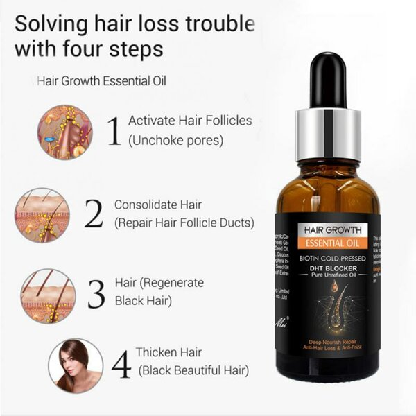 PEIMEI Ginger Hair Care Essential Oil 30ml