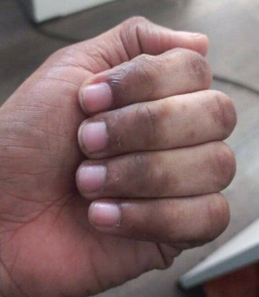 Kit quinto lotion et crème