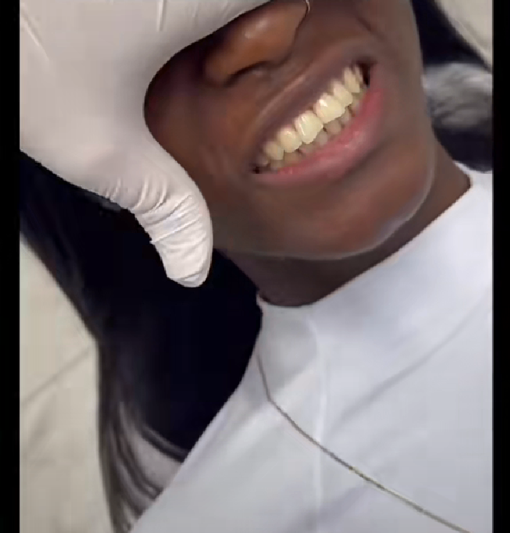 Kit de Blanchiment Dentaire LED