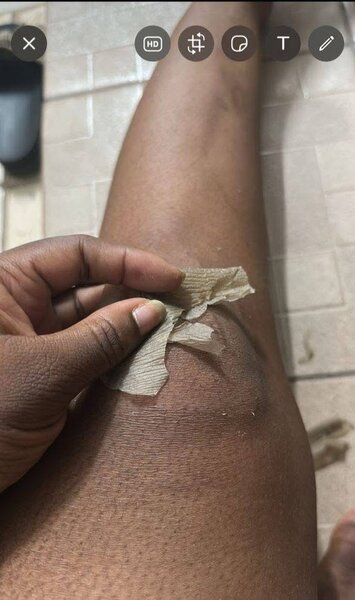 Lotion peeling très efficace