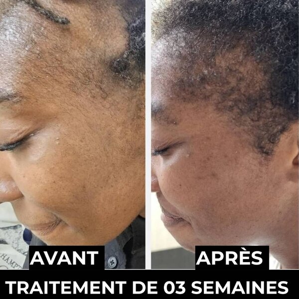 Kit Capillaire Croissance