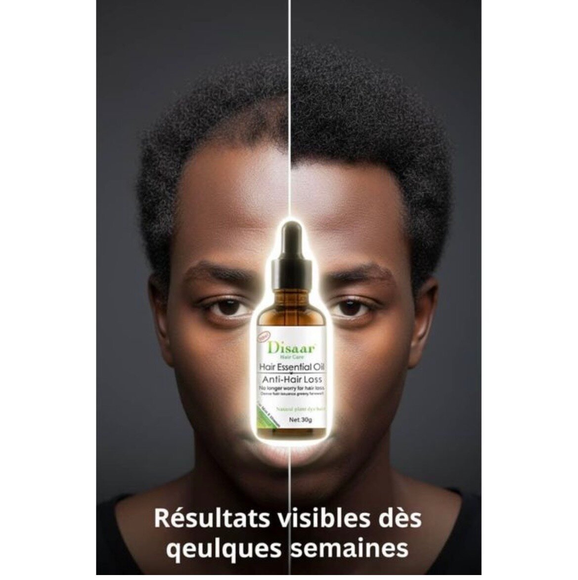 Huile Essentielle Anti-Chute Disaar