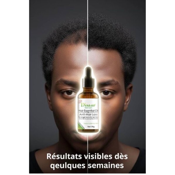 Huile Essentielle Anti-Chute Disaar