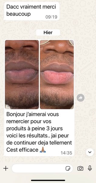 Kit Exfoliant Lèvres Kira Beauty