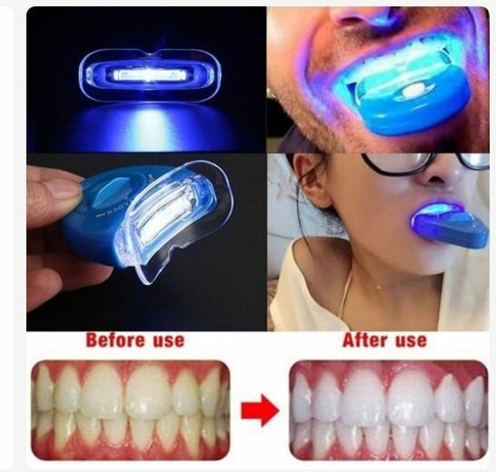 Appareil de blanchissement dentaire