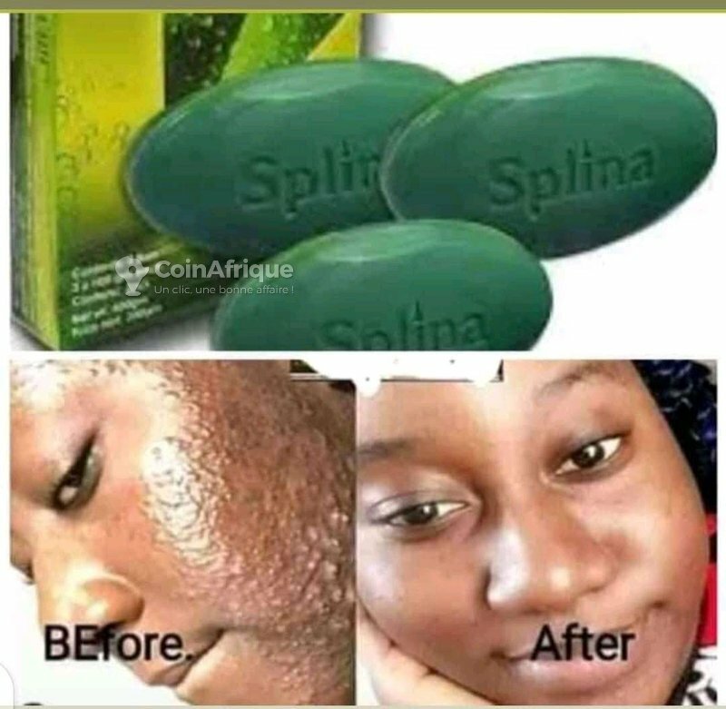 Savon Chlorophylle Splina - Soin Visage Anti-Boutons et Imperfections