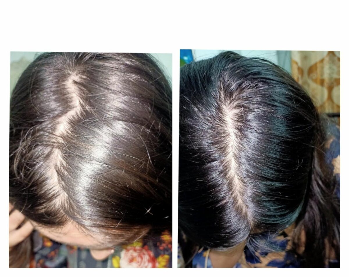 SAMEER ORGANIC shampoo