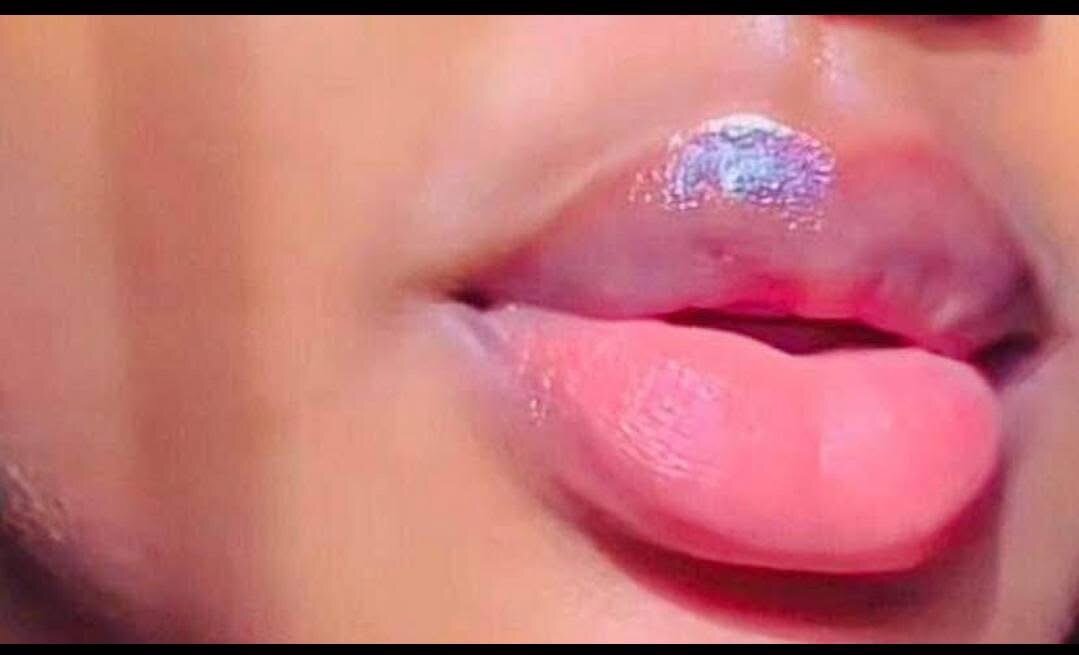 Patch lèvres hydratant