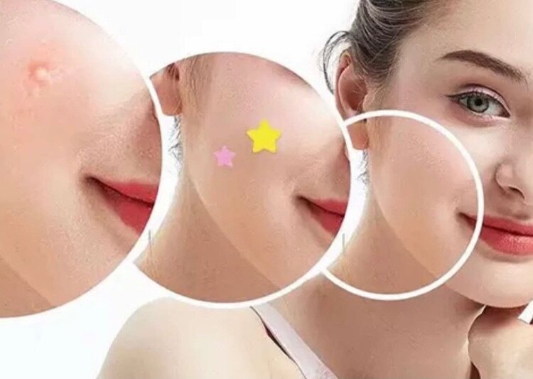 Patch anti-imperfections colorés