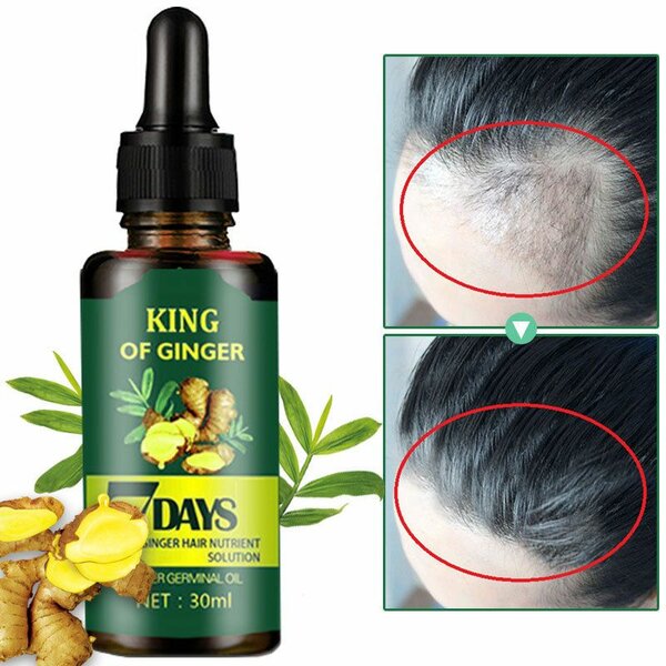 Hair growth oil
