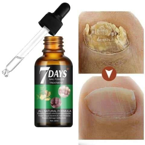 7DAYS NAIL FUNGUS TREATMENT