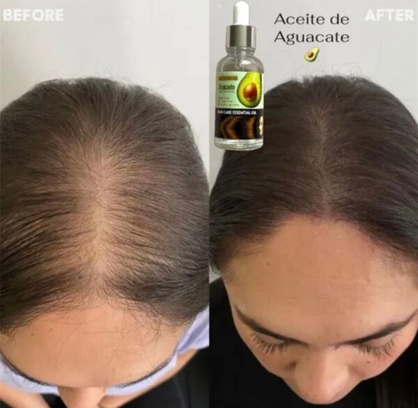 Huile Avocat Cheveux Soin