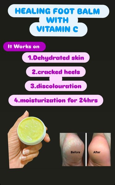 HEALING FOOT BALM with vitamin c
