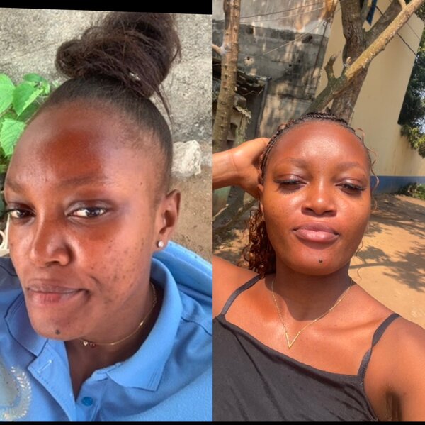 Savon clarifiant le visage