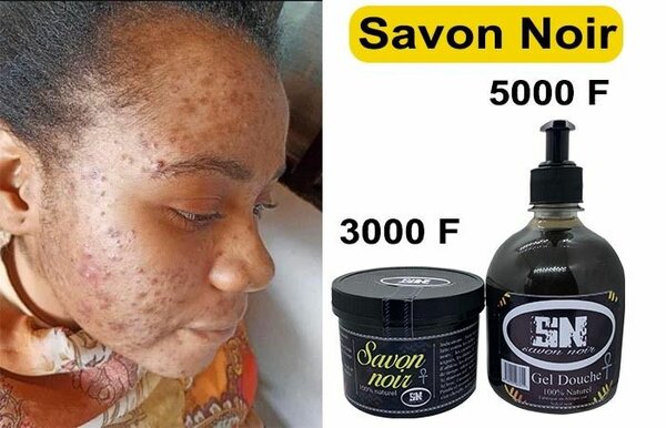 Savon Noir détails et gros  +225 0503803240|+225 0787613240