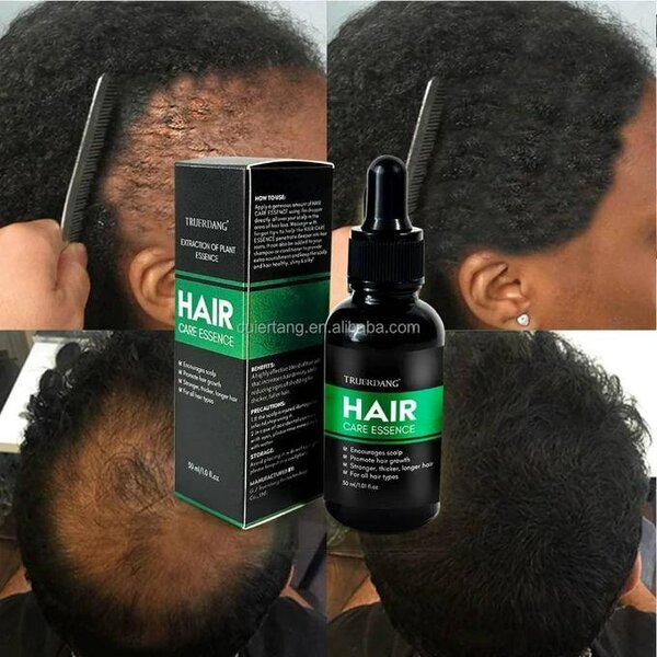Essence capillaire Truerdang