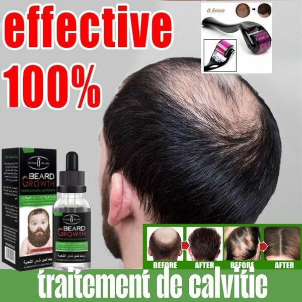 Rouleau pour Repousse Cheveux