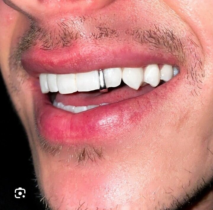 Sliver/Gold teeth and Toe Rings