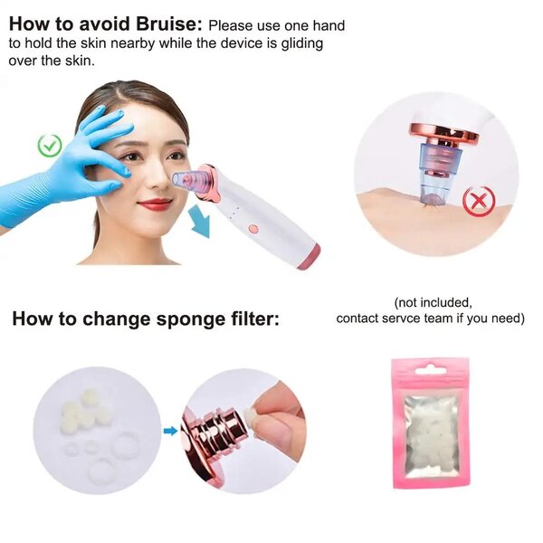 Aspirateur de Points Noirs