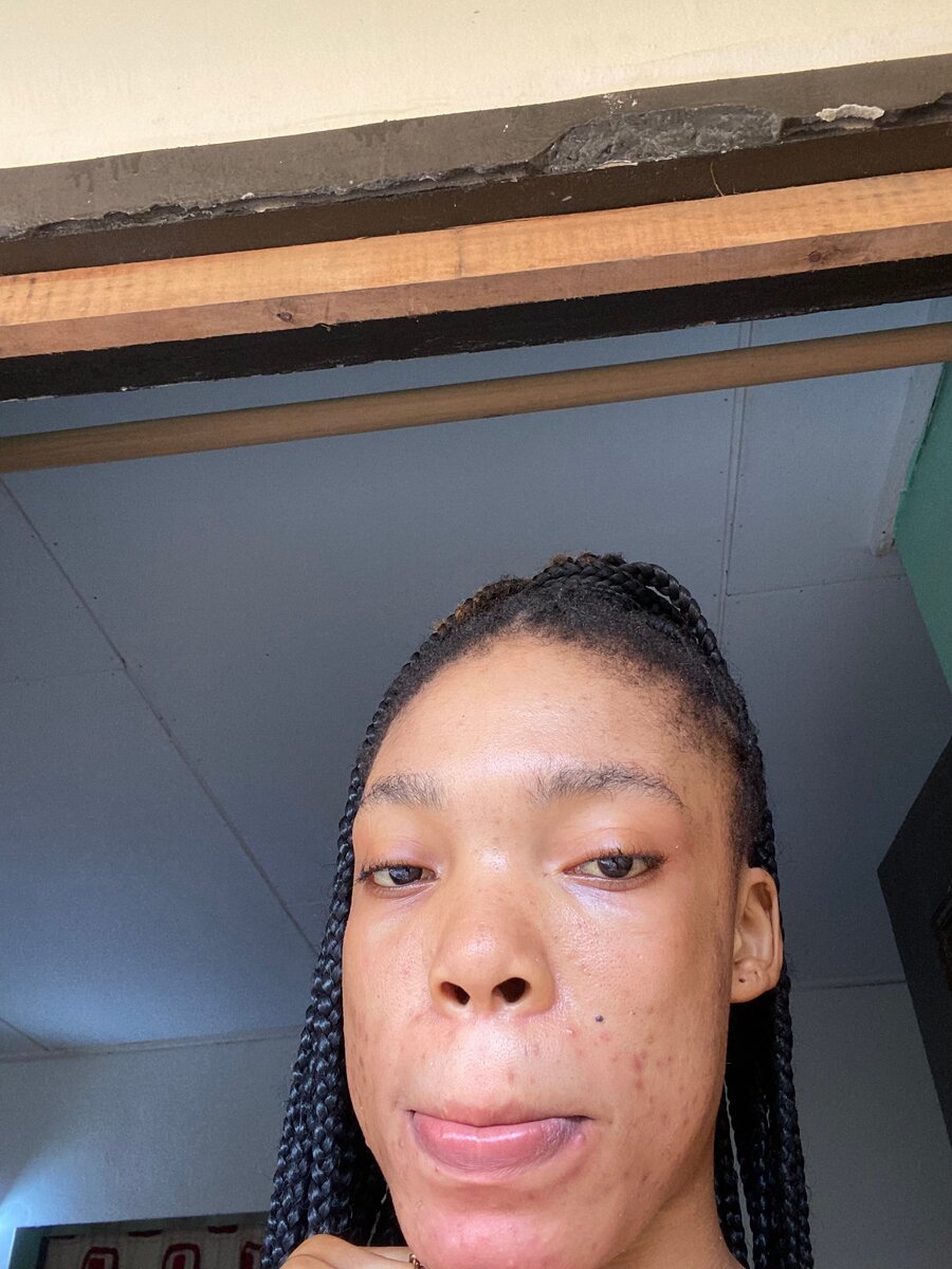 Set de Soin Visage Éclatant