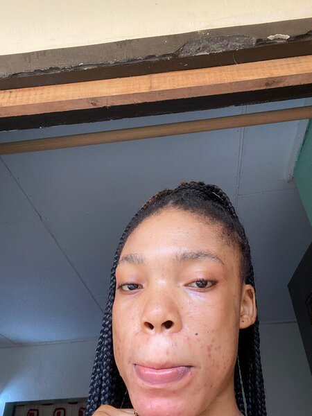 Set de Soin Visage Éclatant