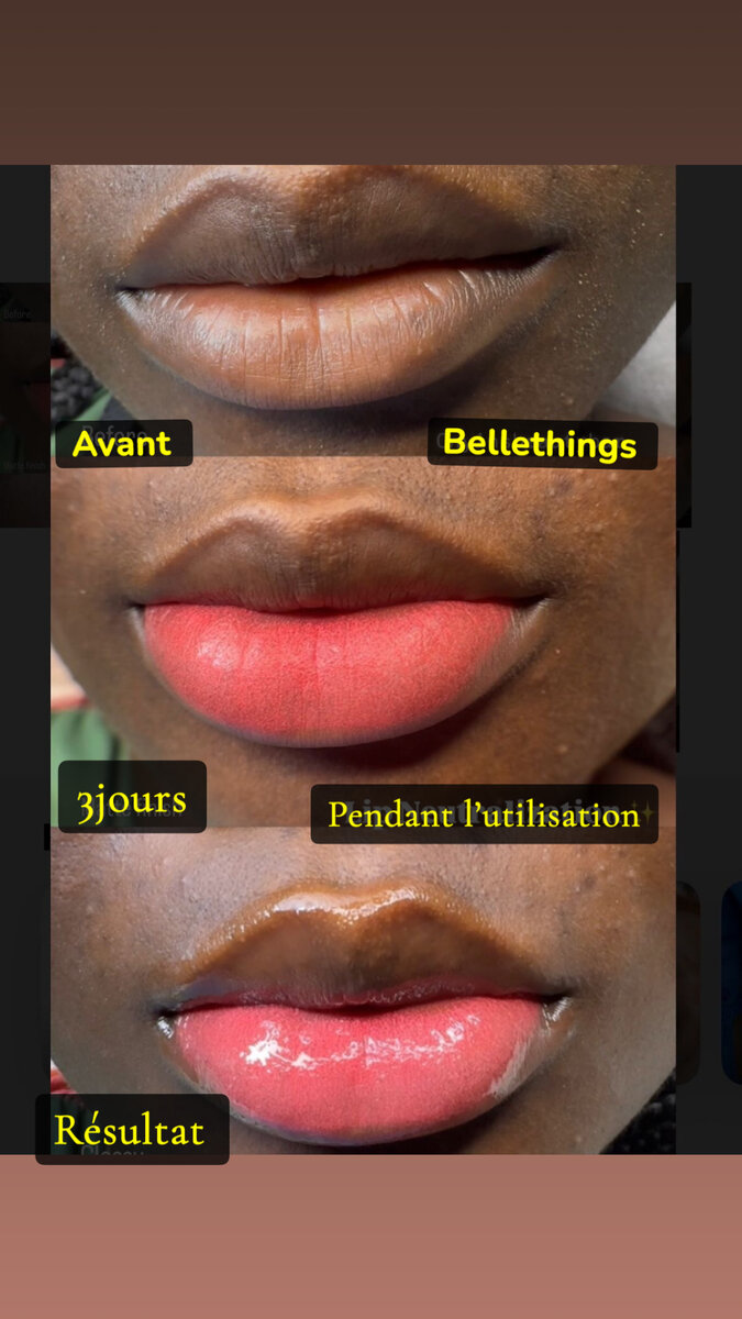 Exfoliant Lèvres Bellethings