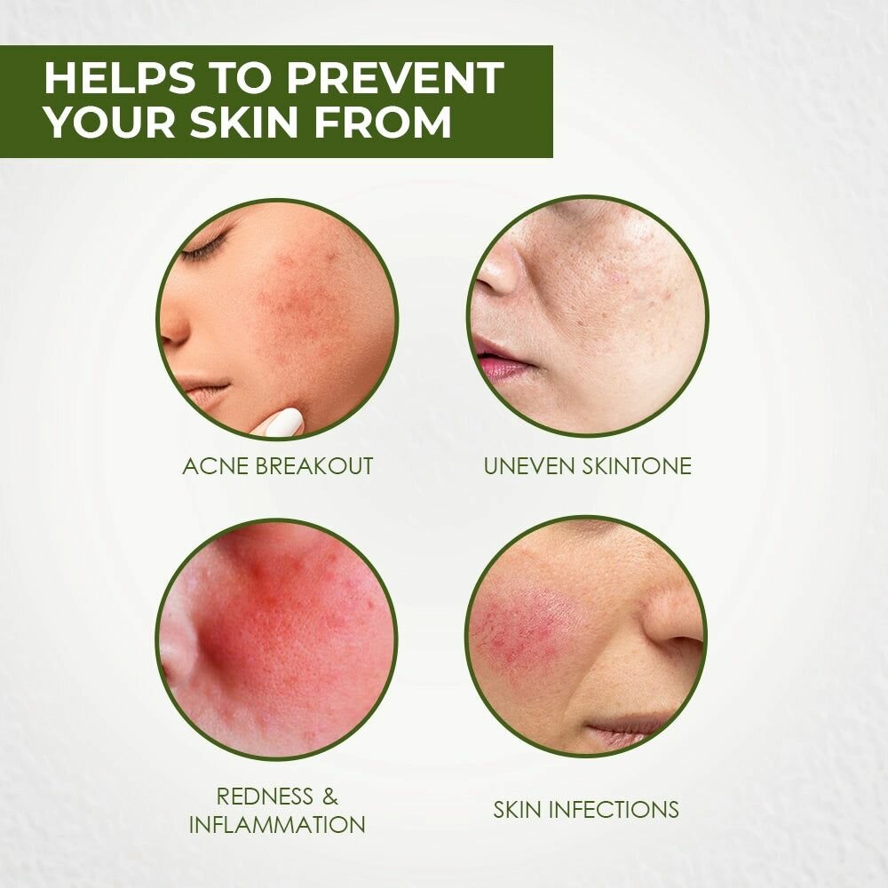 Tea Tree & Neem Anti-Acne and pimple Clear Super Serum